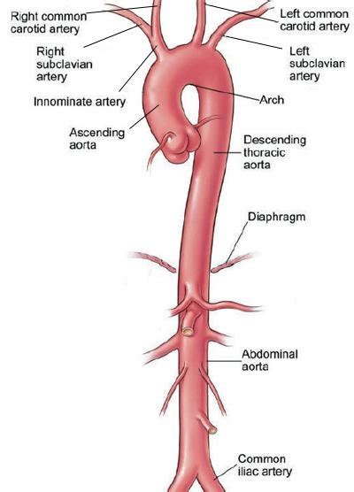 Shows The Aorta Trunk And Its Main First Level Arteries Branches