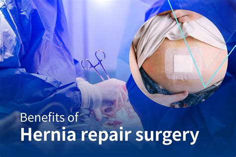 Benefits And Risks Of Hernia Repair Surgery Dr Vijaykumar C Bada