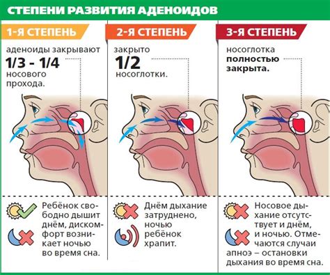 У ребенка заложен нос, но нет соплей. Причины, как и чем лечить в ...