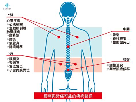 腰背痛全解析上背痛中背痛下背痛腰痛圖解位置與疾病 維力骨科診所