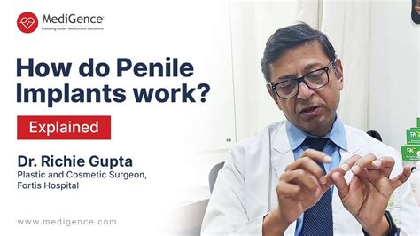 How Do Penile Implants Work Explained By Dr Richie Gupta Youtube