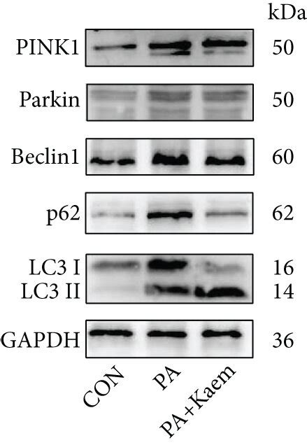 Expression Of Proteins Related To Mitophagy And Mitochondrial Download Scientific Diagram