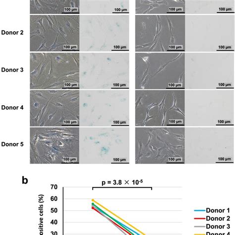 Senescence Associated Beta Galactosidase Sa Gal Staining A Phase