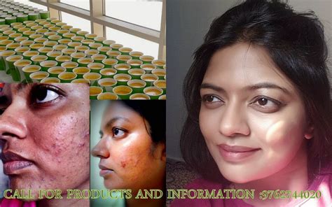 SKIN CARE HERBALIFE INDEPENDENT ASSOCIATE : Results of herbalife skin