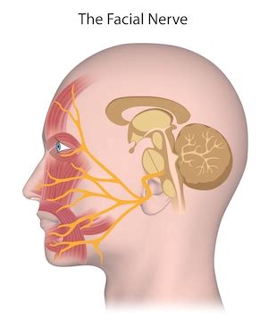 Facial Nerve Disorders — Texas Ear Clinic