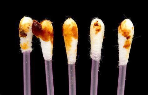 The Color And Texture Of Your Earwax Reveals Everything About Your