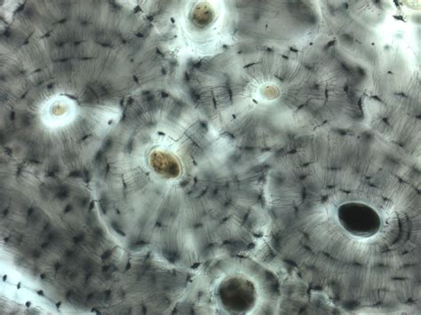 Skeletal Tissue Histology