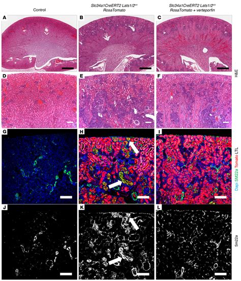 Treatment with verteporfin, a Yap inhibitor, partially rescues Lats1/2 ... 