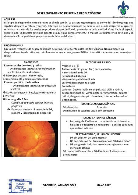 Desprendimiento De Retina Regmat Geno Naitsab S Guill N Leyva Udocz