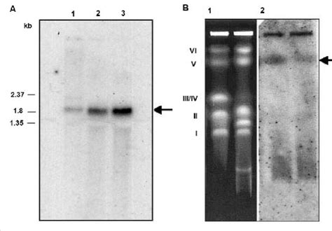 A Northern Blot Hybridization Of The Ylsrp72 Gene Using A Probe Of