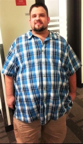 Silver Cross Bmi Surgery Helped Suburban Man Build A Success Story