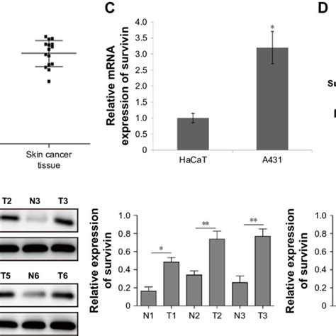 survivin expression is upregulated in skin cancer patients and cell ... 