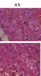 Serum Alt Level And Histological Analysis Of Livers After Anti Fas