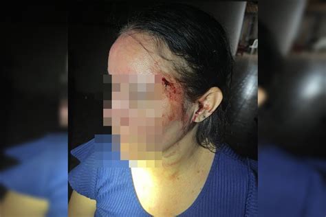 Bêbado PM do DF é preso após espancar mulher coronhadas na cabeça