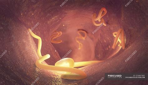 Bandwurmbefall Im Menschlichen Darm Digitale Illustration Hygiene
