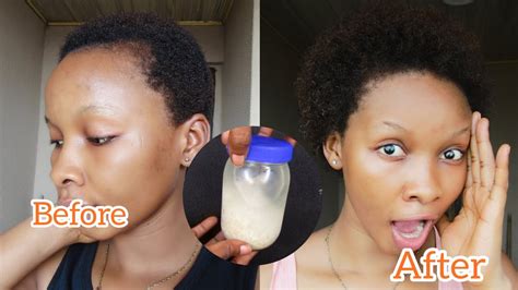 How I Grew My Hair In Just 2 Weeks With Rice Water How To Make