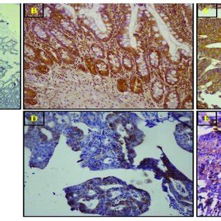 Representative Immunohistochemical Images Showing Expression Of The