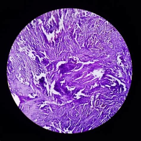 Histopathological Confirmation Of Vascular Malformation Download Scientific Diagram