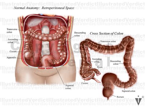 Ascending Colon Retroperitoneal