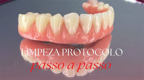 Limpeza De Protocolo Implante F Cil Youtube