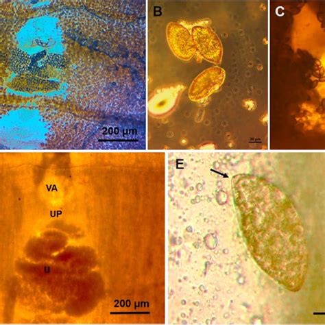 Whole Mounted Samples From Sparganum Proliferum Adult Found In Wild