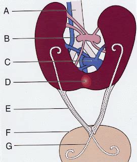 donorcycle: Horseshoe Kidney