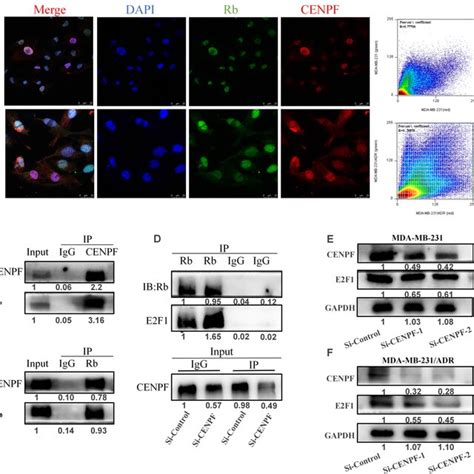 Cenpf Is Highly Expressed In Triple Negative Breast Cancer A Cenpf