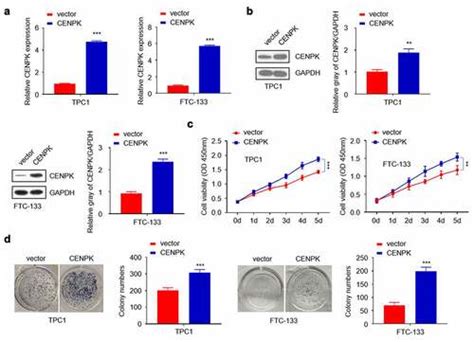 Full Article Overexpression Of Centromere Protein K Cenpk Gene In