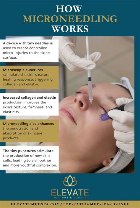 Four Facts To Know About Microneedling Learn More Elevate Med Spa