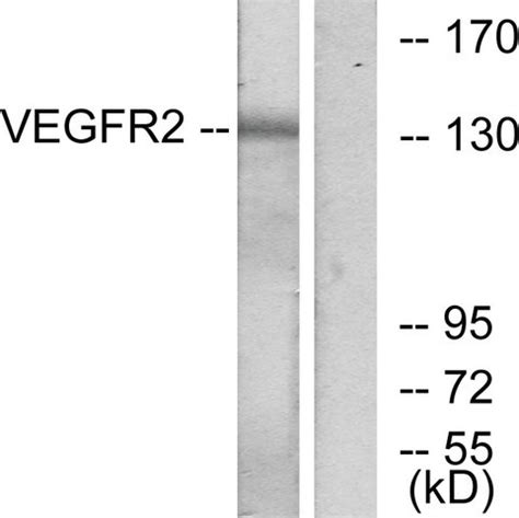 Anti VEGFR2 Antibody Produced In Rabbit