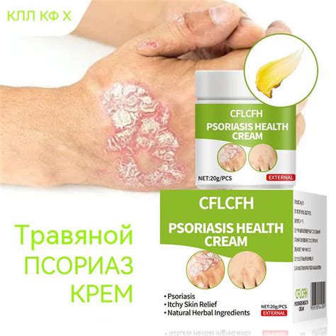 Крем от псориаза подходит для лечения экземы дерматита растительные ...
