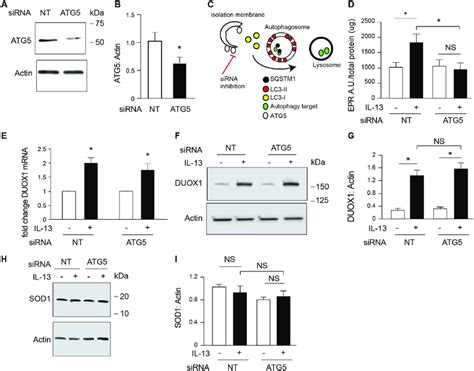 Airway Epithelial Cell Cytoplasmic Superoxide Requires Autophagy A