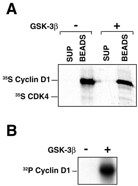 Ubiquitination Of Free Cyclin D1 Is Independent Of Phosphorylation On