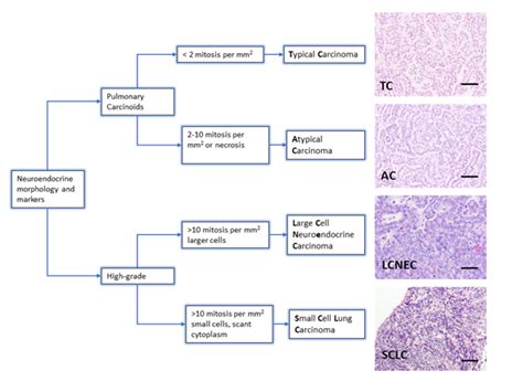 Neuroendocrine Lung Cancer Mouse Models Encyclopedia Mdpi