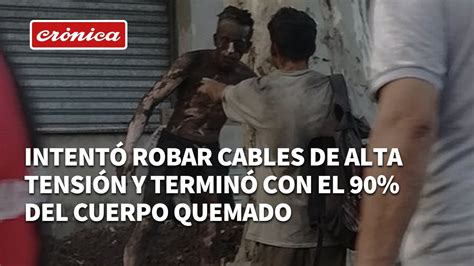 Intentó robar cables de alta tensión se electrocutó y terminó con el