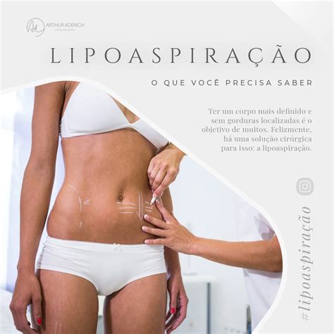 Lipoaspiração o que você precisa saber Dr Arthur Koerich