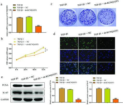 Downregulation Of KCNQ1OT1 Inhibited Cell Proliferation Of