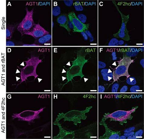 Novel Cystine Transporter In Renal Proximal Tubule Identified As A