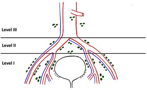 Frontiers The Adequacy Of Pelvic Lymphadenectomy During Radical Cystectomy For Carcinoma