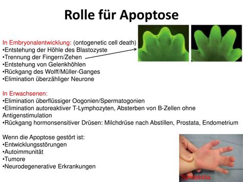 Ppt Zellzyklus Zellteilung Zelldifferenzierung Zelltod