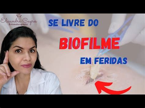 SE LIVRE DO BIOFILME EM FERIDAS ESTOMATERAPIA YouTube