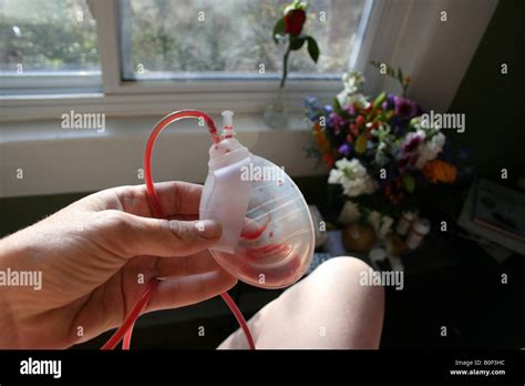 patient holding a Passy-Muir tube of blood, vent, valve,, drain ...