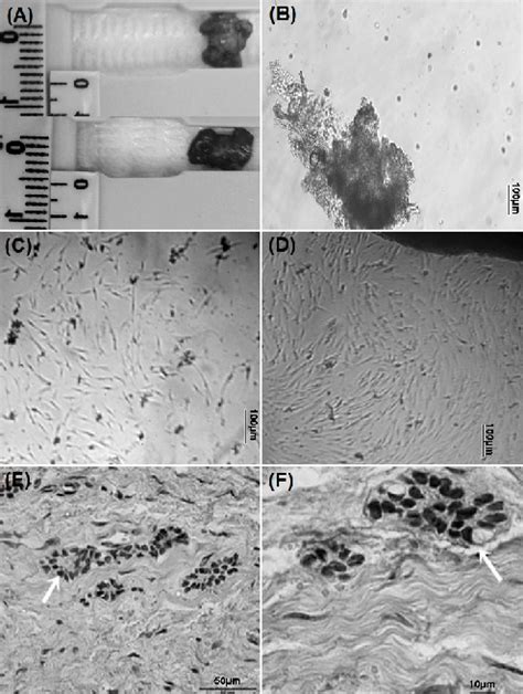 Dental Follicle Cell Culture And Histopathological Analysis A