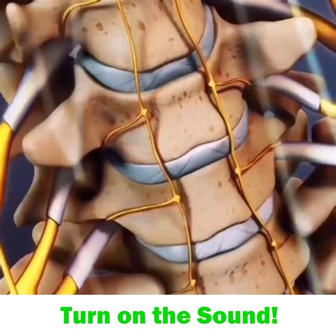 Have an l4 l5 pars defect in your spine it might be spondylolisthesis