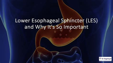 The Lower Esophageal Sphincter And Its Connection To Heartburn Acid