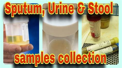 Urine R E Test At Tirur Malappuram At Inhaero Lab