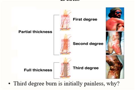 Peds Final 2024 Flashcards Quizlet