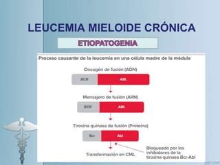 Leucemia Mieloide Cr Nica Huamanchumo Sandoval Samaria Ppt