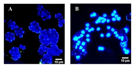 Morphological changes of HT-29 cells using DAPI staining and visualized ... 