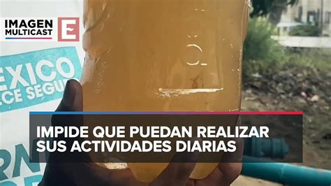 Veracruz Agua Contaminada Causa Ronchas En La Piel A Vecinos De